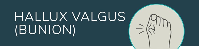 Striding Forward - Understanding and Managing Bunions and Claw Toes