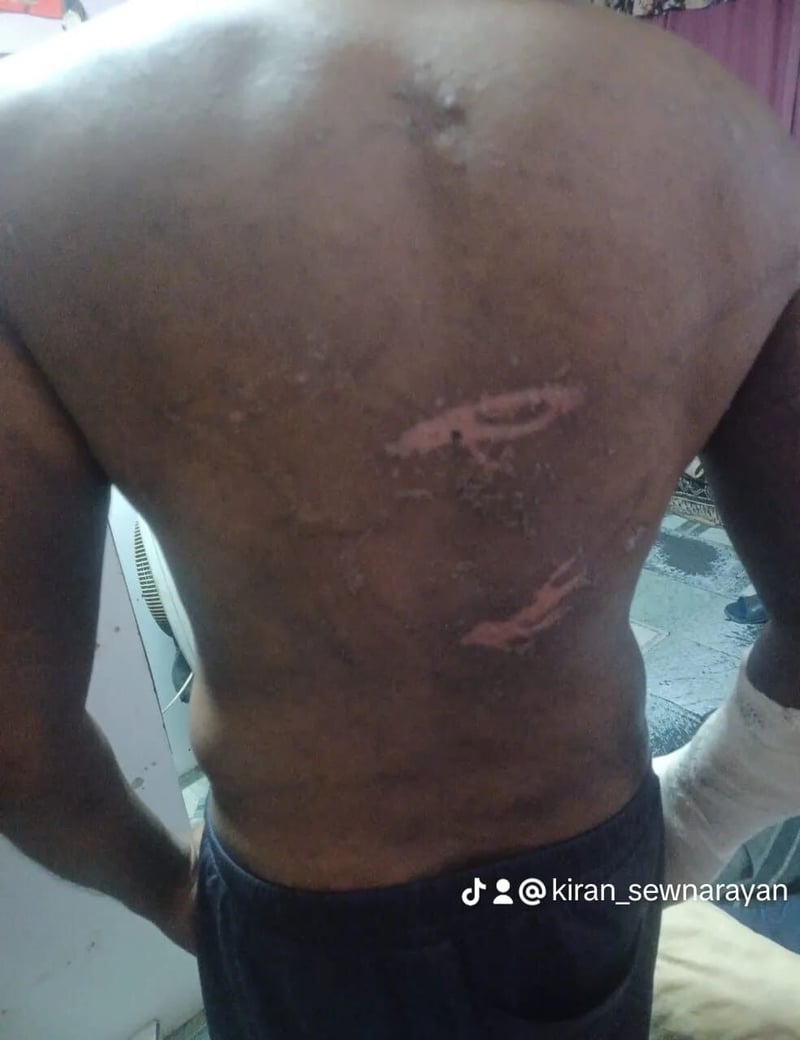 Oppose bail for those arrested for Kidnapping and attempting to murder Kiran Sewnarayan