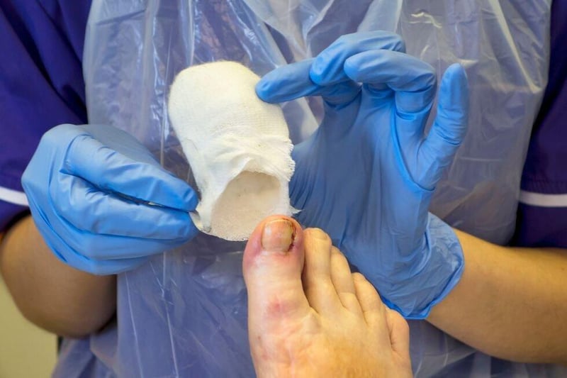 Ingrown Toenail Solutions Answers the Question Patients Are Too Nervous to Ask About Toenail Surgery
