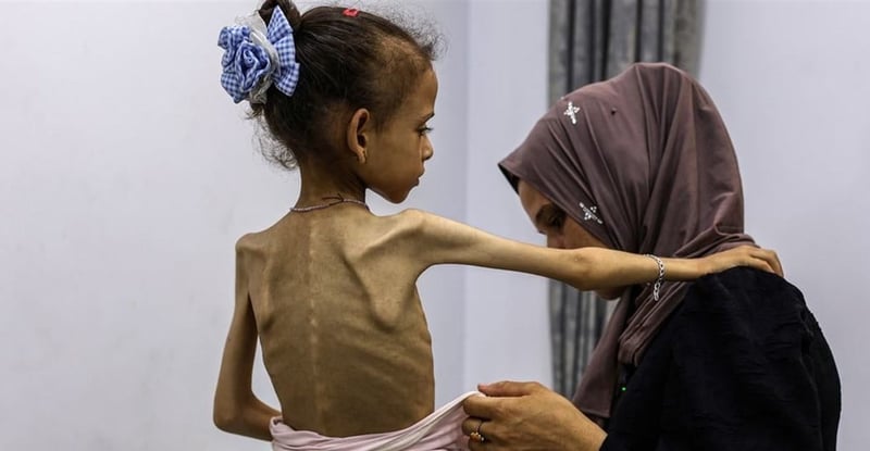 The Science of Starvation Understanding How Food Deprivation Impacts the Human Body and Health