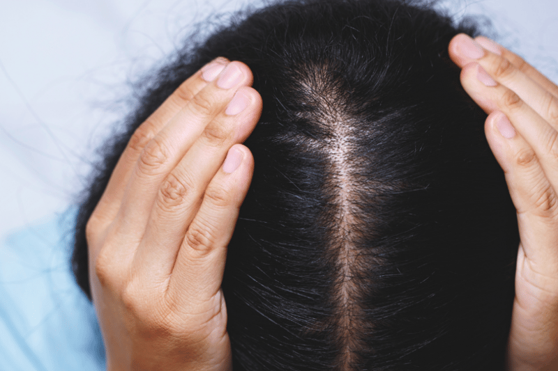 Understanding Hair Loss and Where to Find Real Help