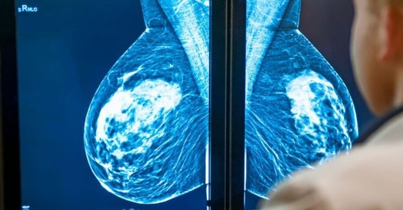 Understanding Mammograms - A Vital Tool in Breast Health