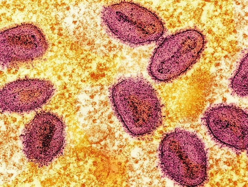 Mpox cases rise across South Africa, with 22 confirmed including new Cape Town case