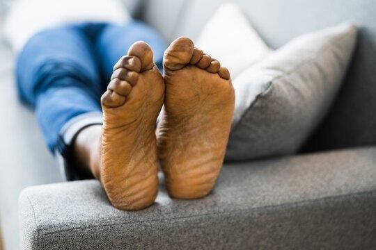 Athletes Can Say Goodbye to Corns and Calluses with These Footcare Tips