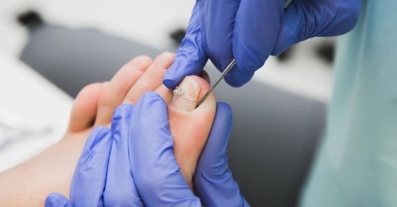 Finding a Podiatrist in Johannesburg - A Step-by-Step Guide