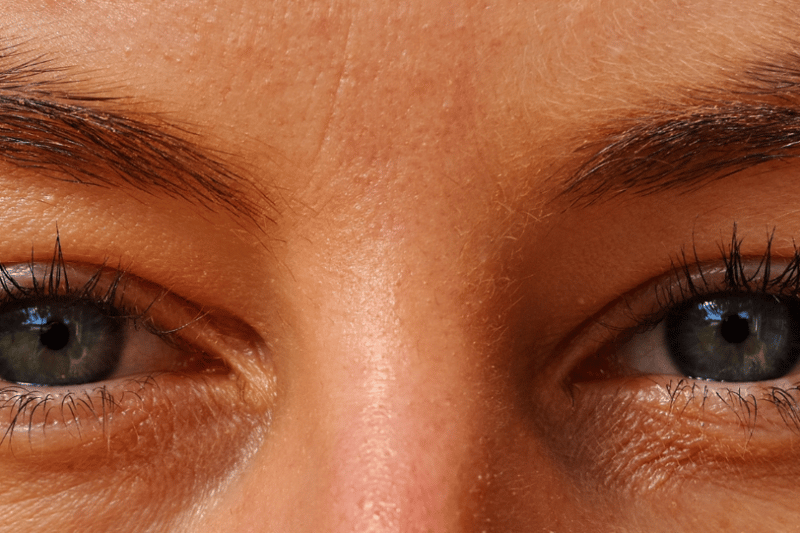 Understanding Eye Care and Vision Surgery in South Africa